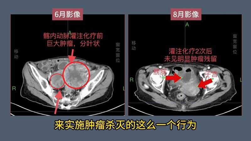 視頻封面