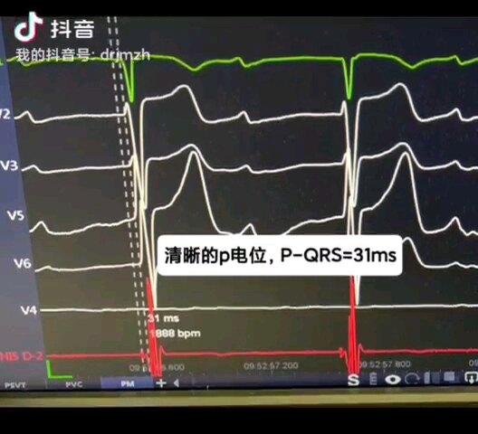 默认图片