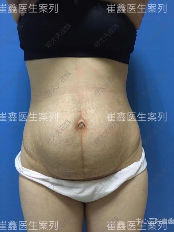 圖文圖片