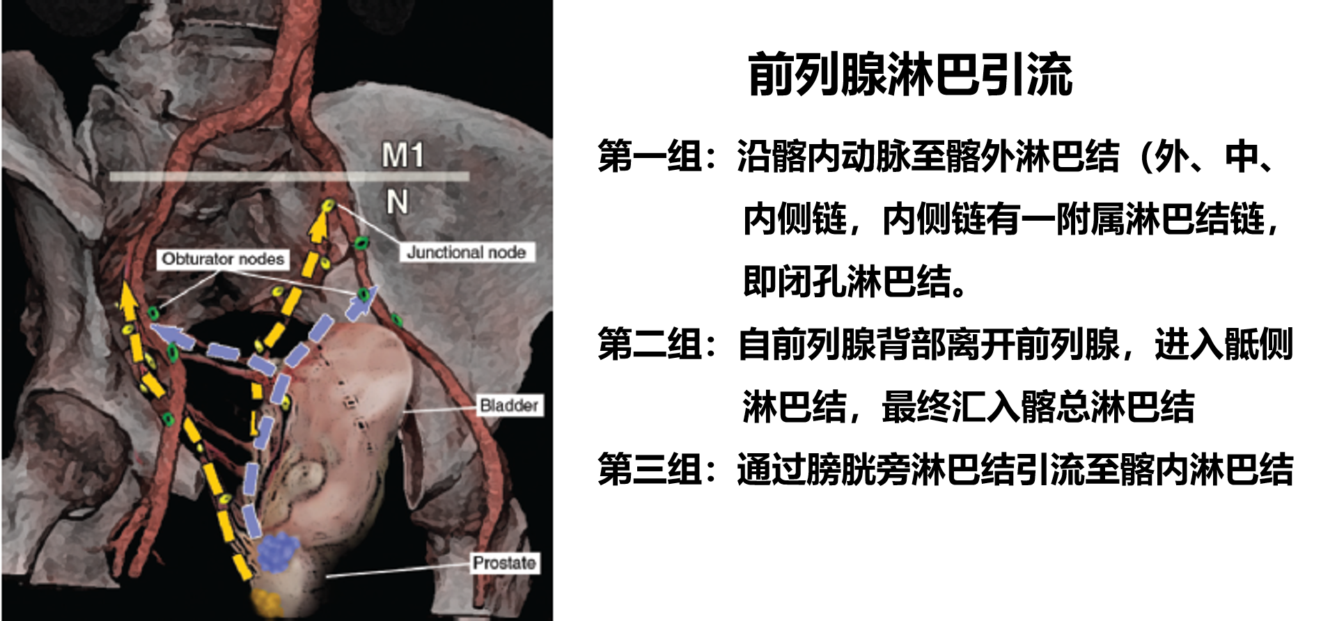前列腺淋巴引流.png
