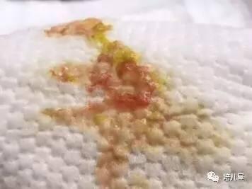 圖文圖片