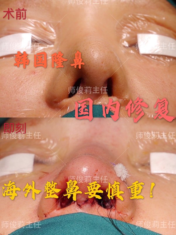 圖文圖片