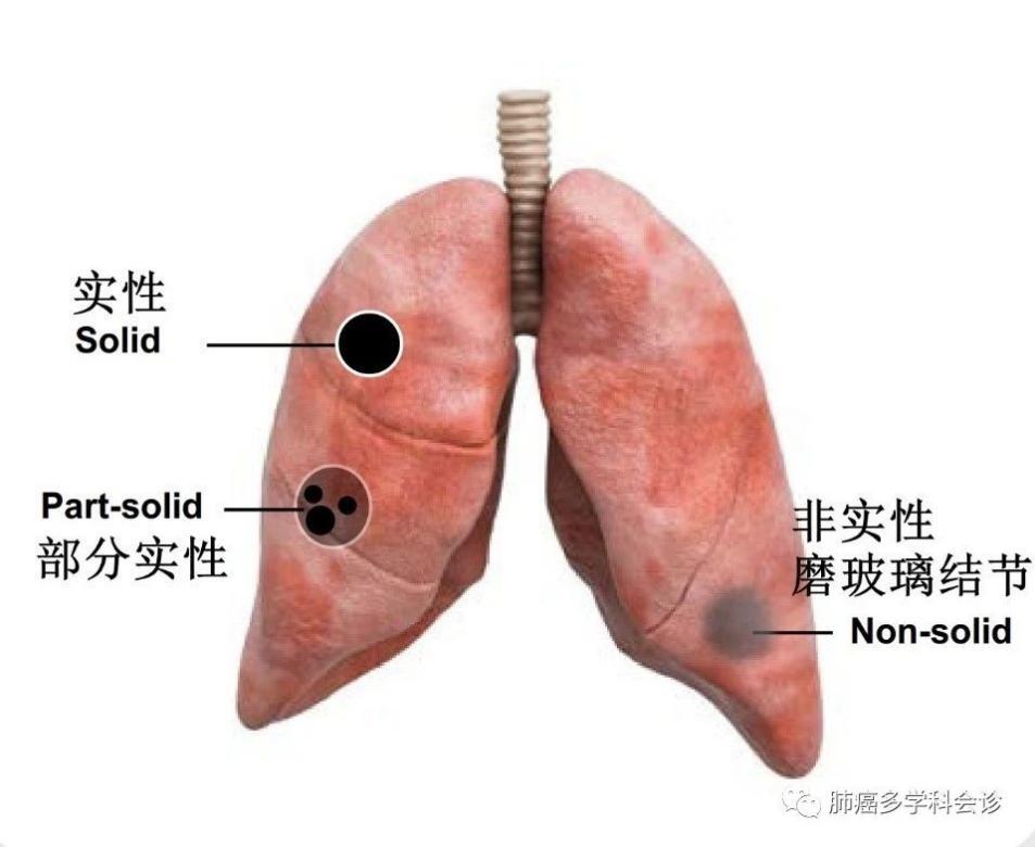 暂无