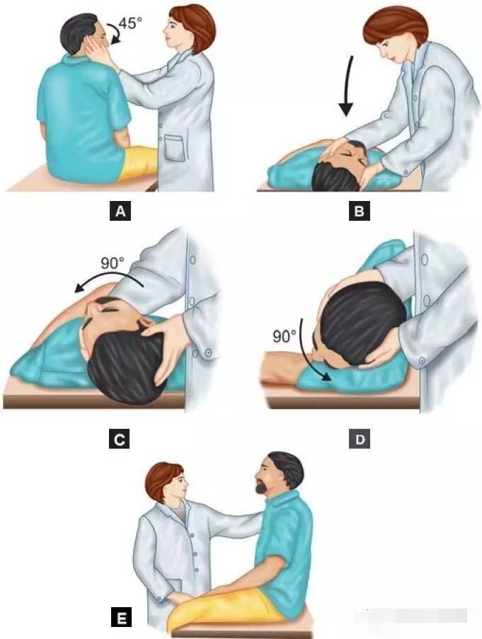 耳石症复位手法 步骤图片