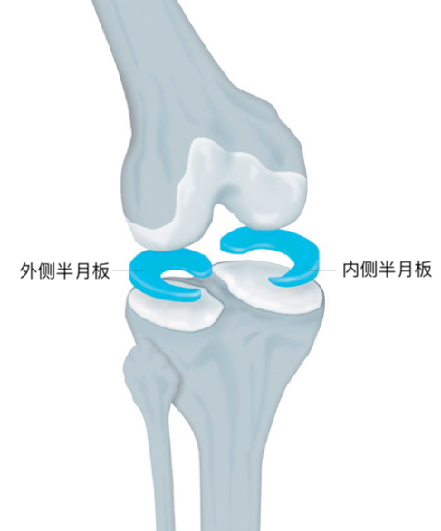 膝关节半月板损伤常见问题解读 膝关节半月板损伤 好大夫在线