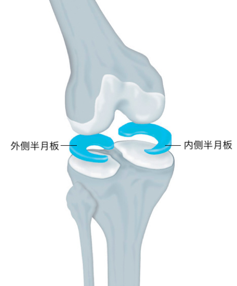 膝关节半月板损伤常见问题解读 膝关节半月板损伤 好大夫在线 膝关节半月板损伤常见问题解读 膝关节半月板损伤 好大夫在线