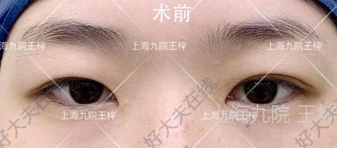 圖文圖片