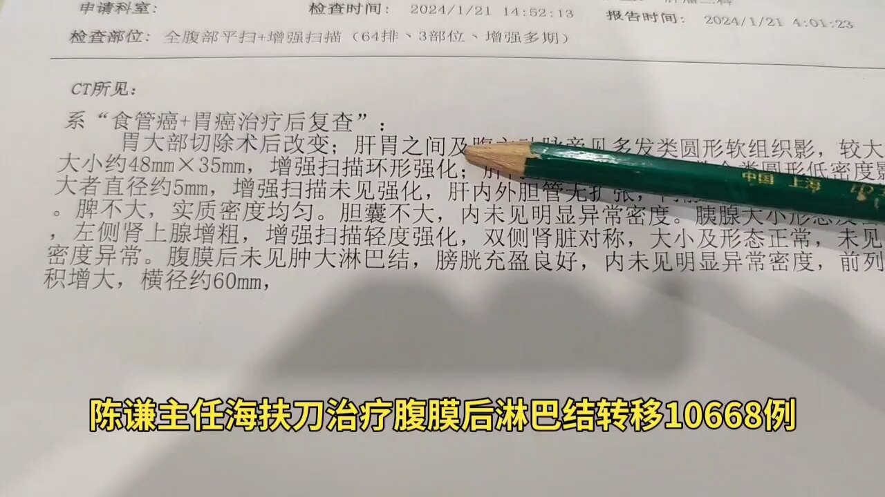 默认图片