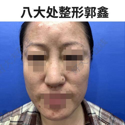 圖文圖片