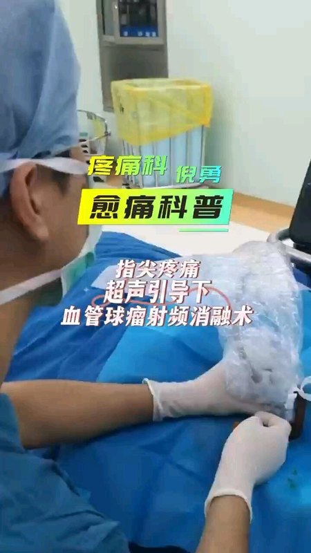 手指血管球瘤-超声引导下射频消融治疗