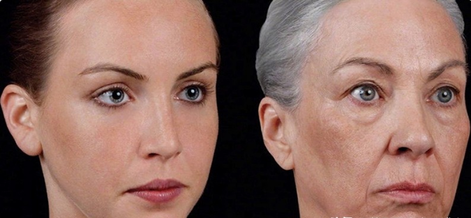 面部衰老1,严格注意防晒阳光中的紫外线是造成皮肤光老化的一大重要