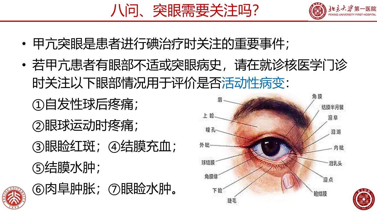 写在2021中华医学会核医学分会最新指南出炉后_甲亢_治疗方式