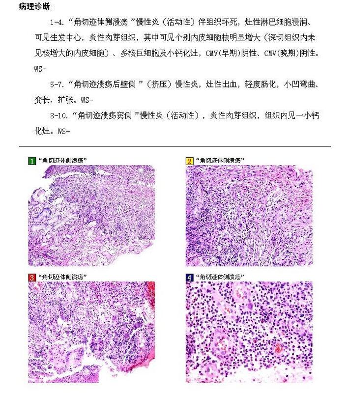 王和平2病理.jpg