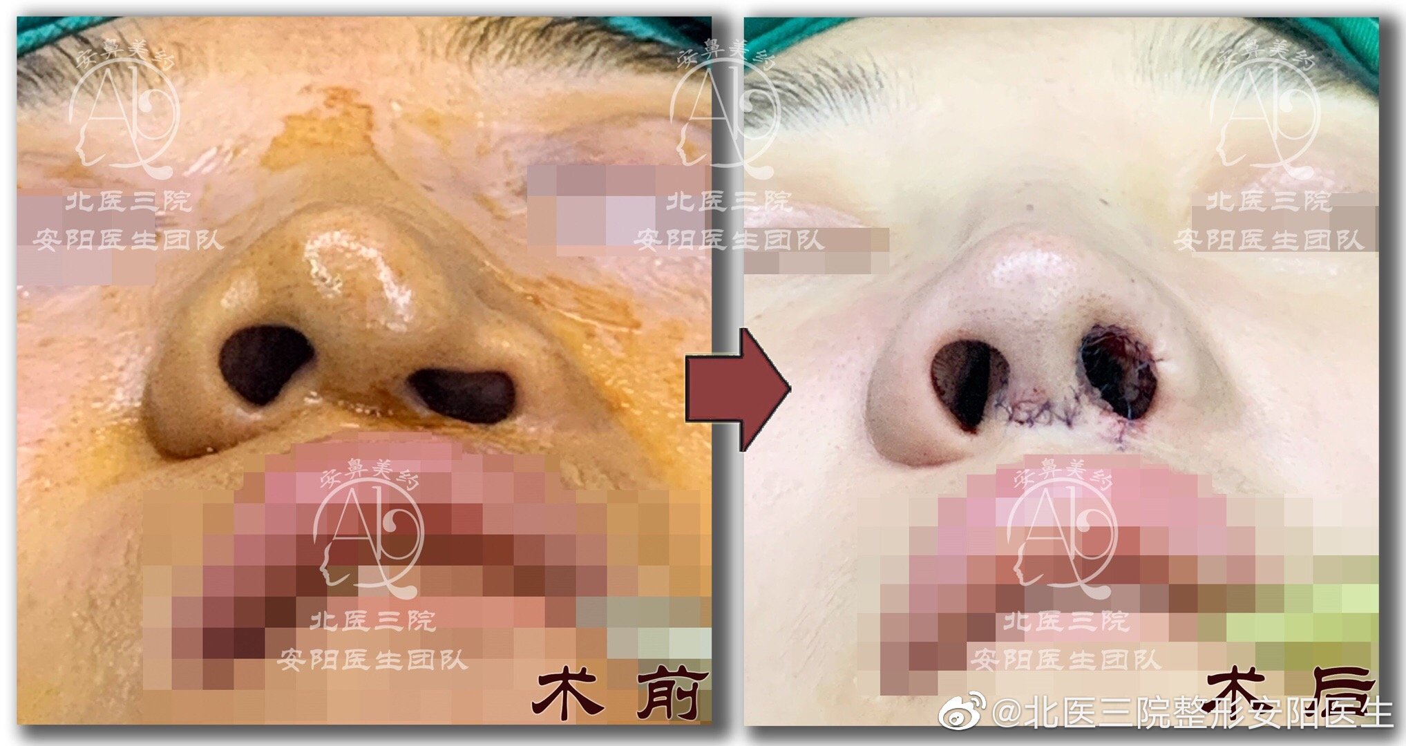 圖文圖片