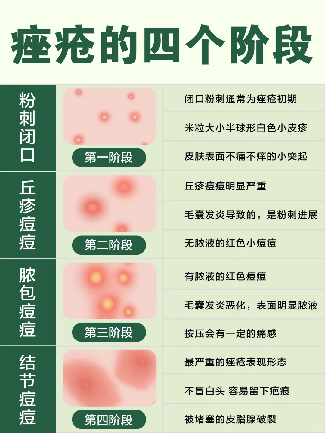 孙世平科普专栏|闭口、粉刺、痘痘三者区别_痤疮_介绍_治疗方式 - 好大夫在线