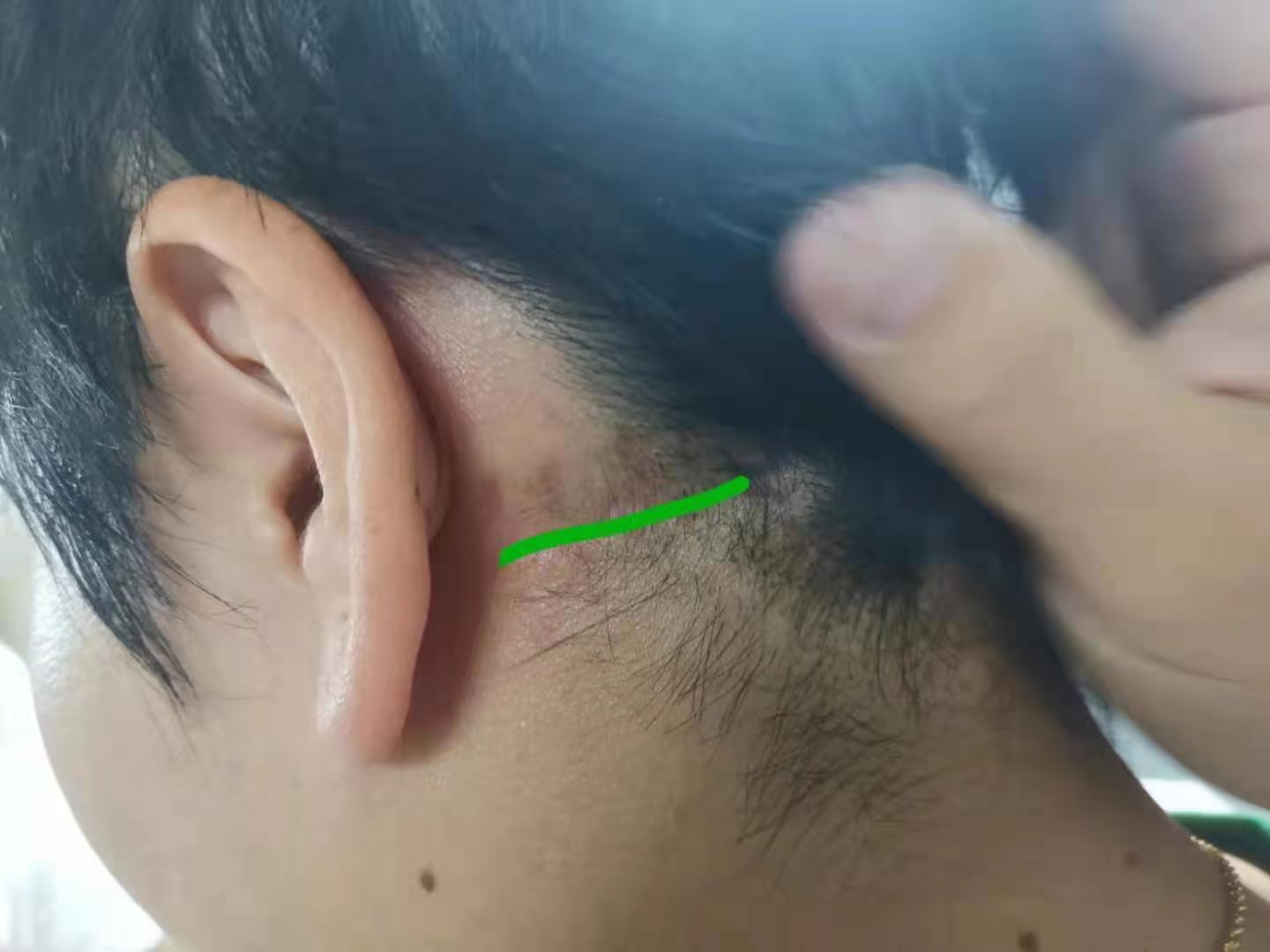 耳朵后面三叉神经图片