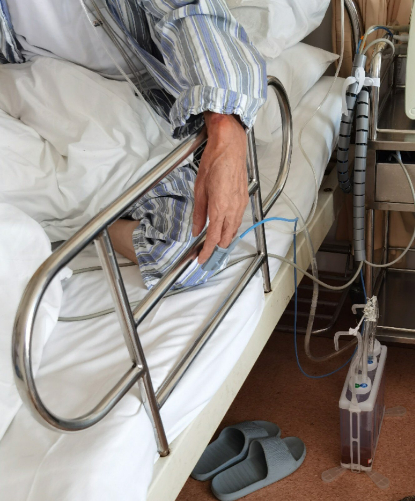 65岁老汉烂肺一年"炸"六次,上厕所再次破裂,胸部插管化险为夷_气胸