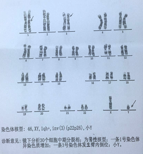 好着急 2号染色体为衍生染色体煞费苦心