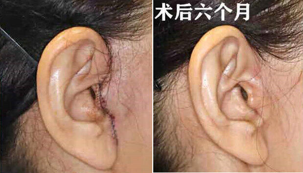 圖文圖片