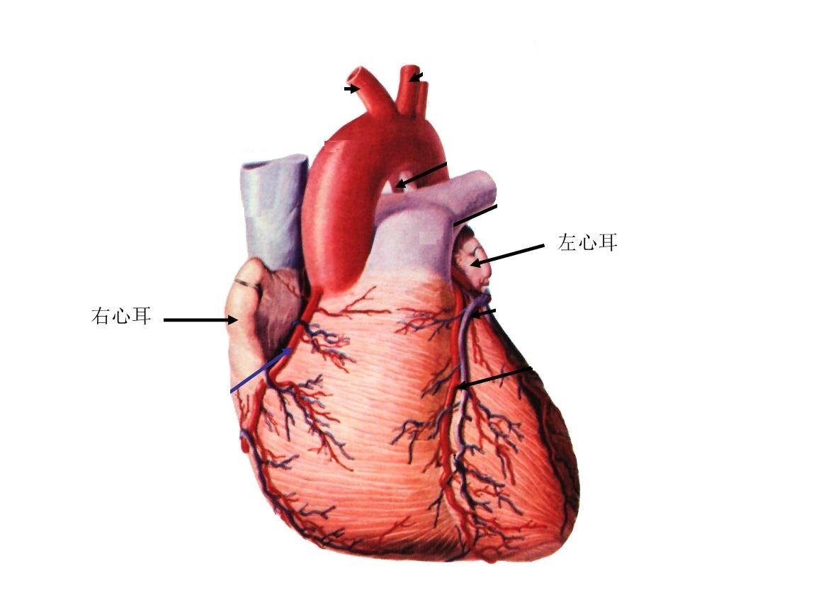 右心耳解剖图图片