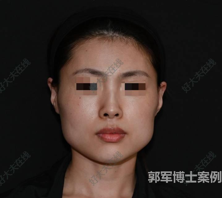圖文圖片