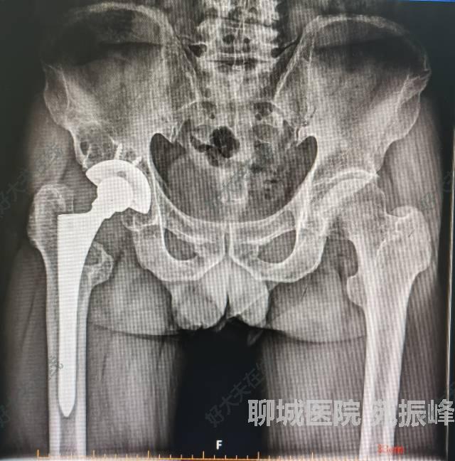 圖文圖片