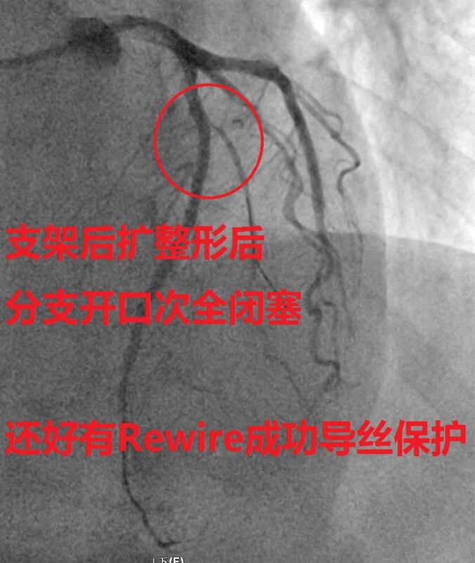 圖文圖片
