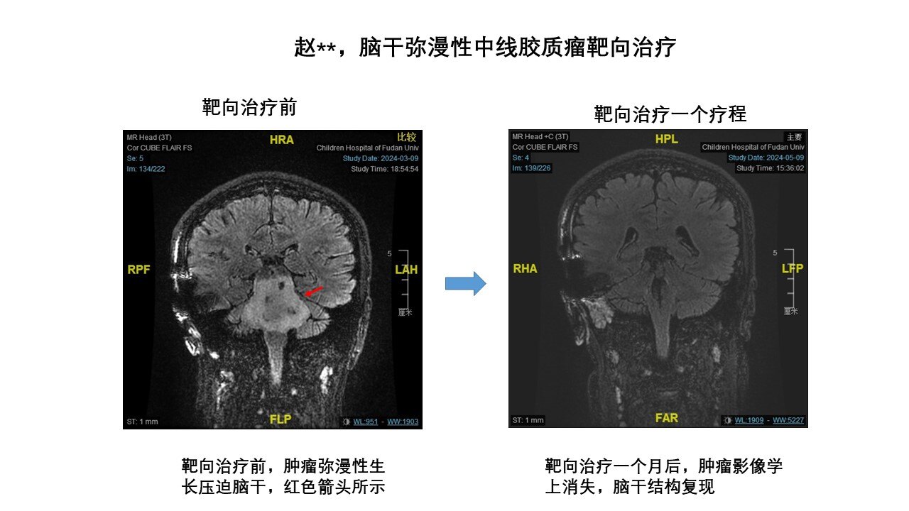 矢状位.jpg