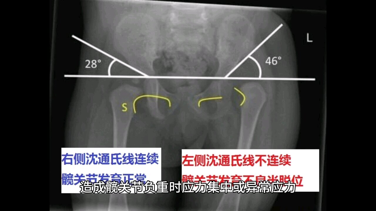 默认图片