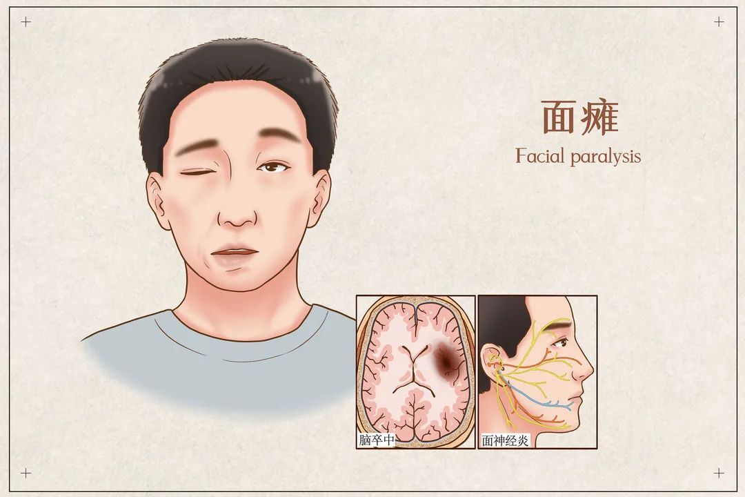 圖文圖片