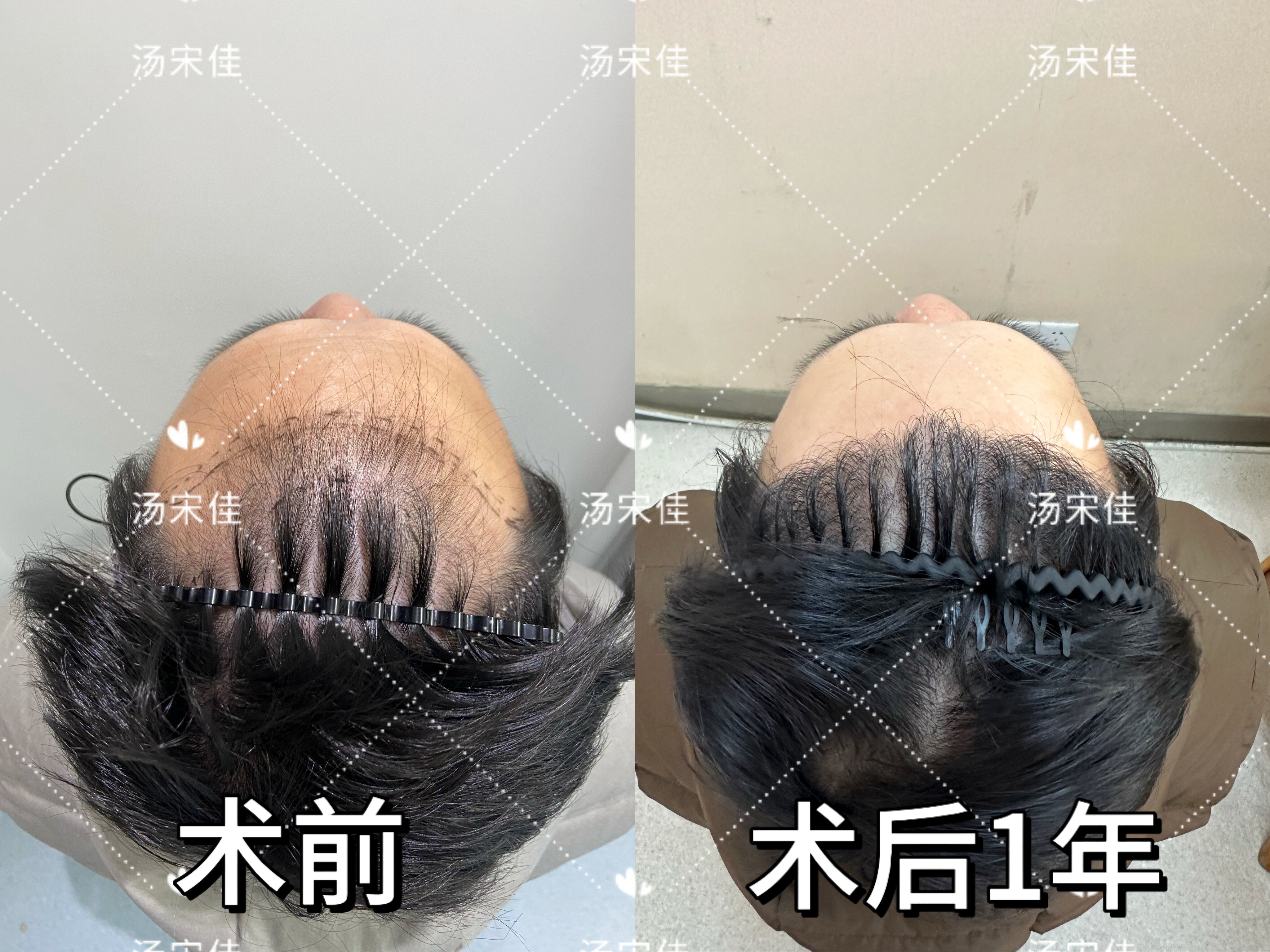 圖文圖片