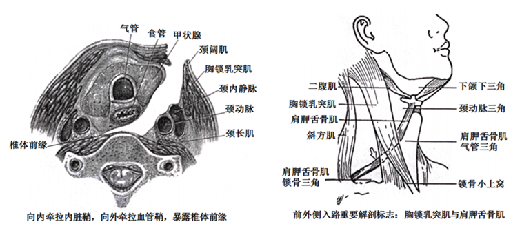 内脏鞘牵向内侧→切开椎前筋膜暴露椎体并定位节段→适当剥离两侧颈长