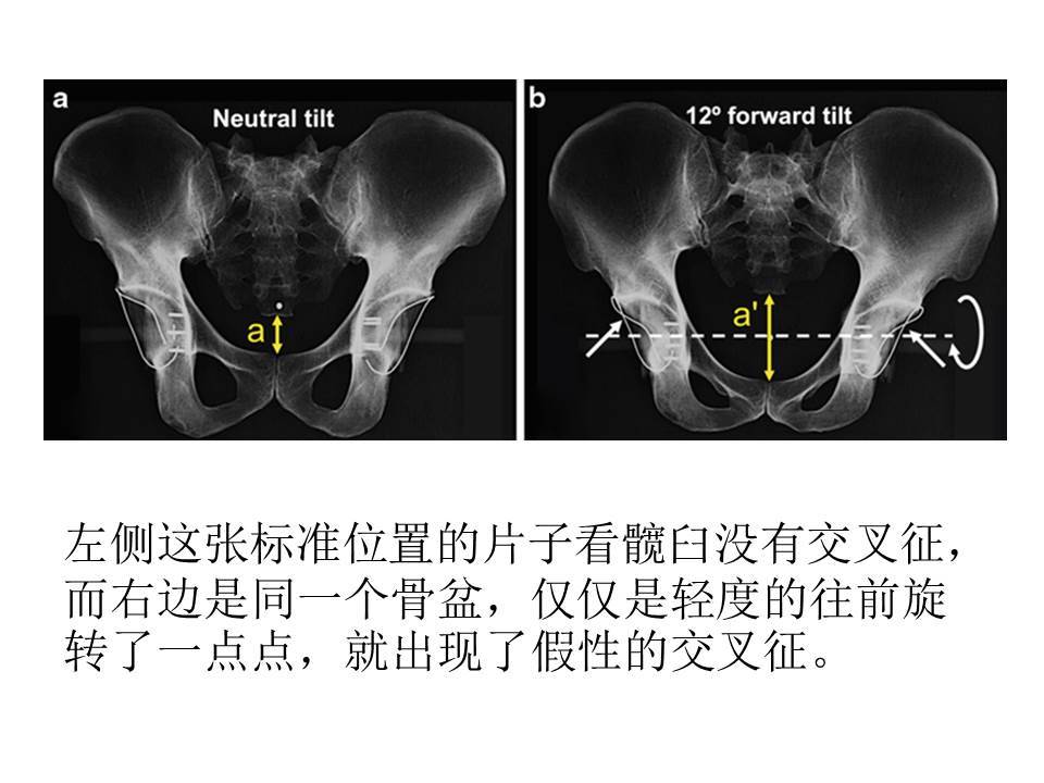 关于拍片的那些事儿