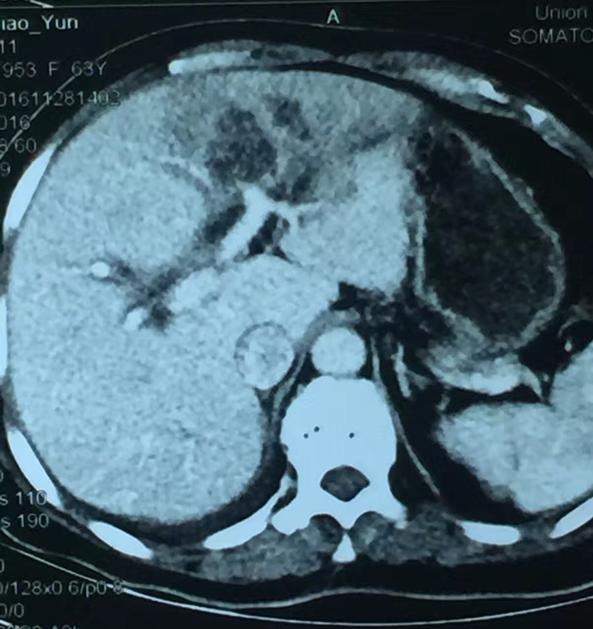 认识"肝岛" - 好大夫在线