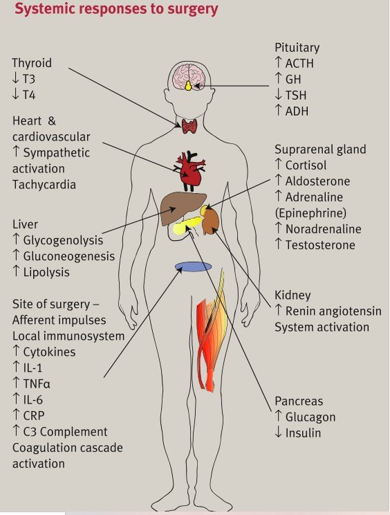 外科手术后应激.jpg
