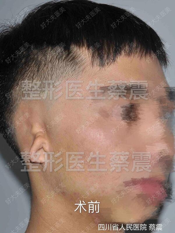 圖文圖片