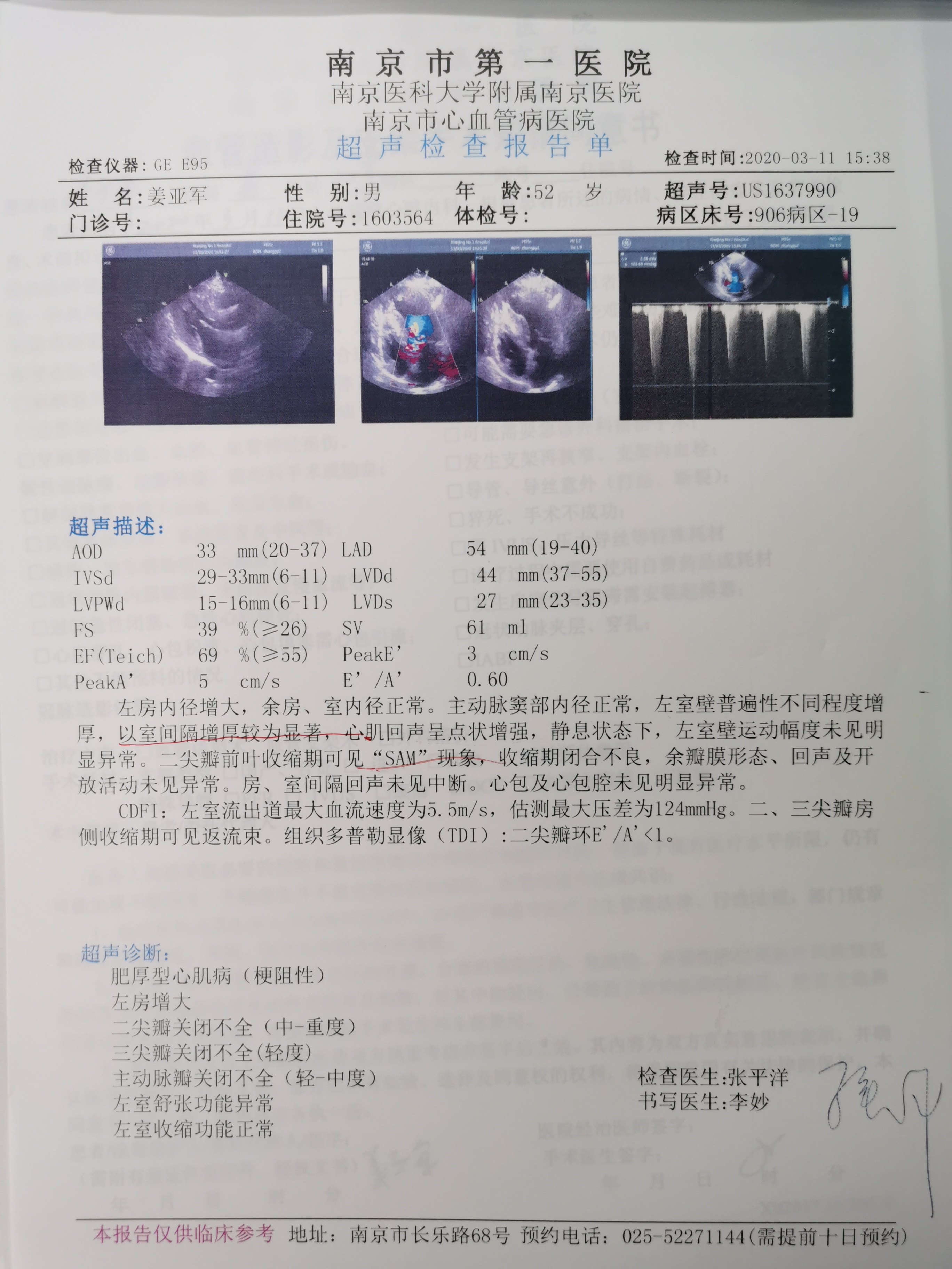 术中食道超声示二尖瓣前叶有sam现象左室流出道狭窄,二尖瓣中重度反流