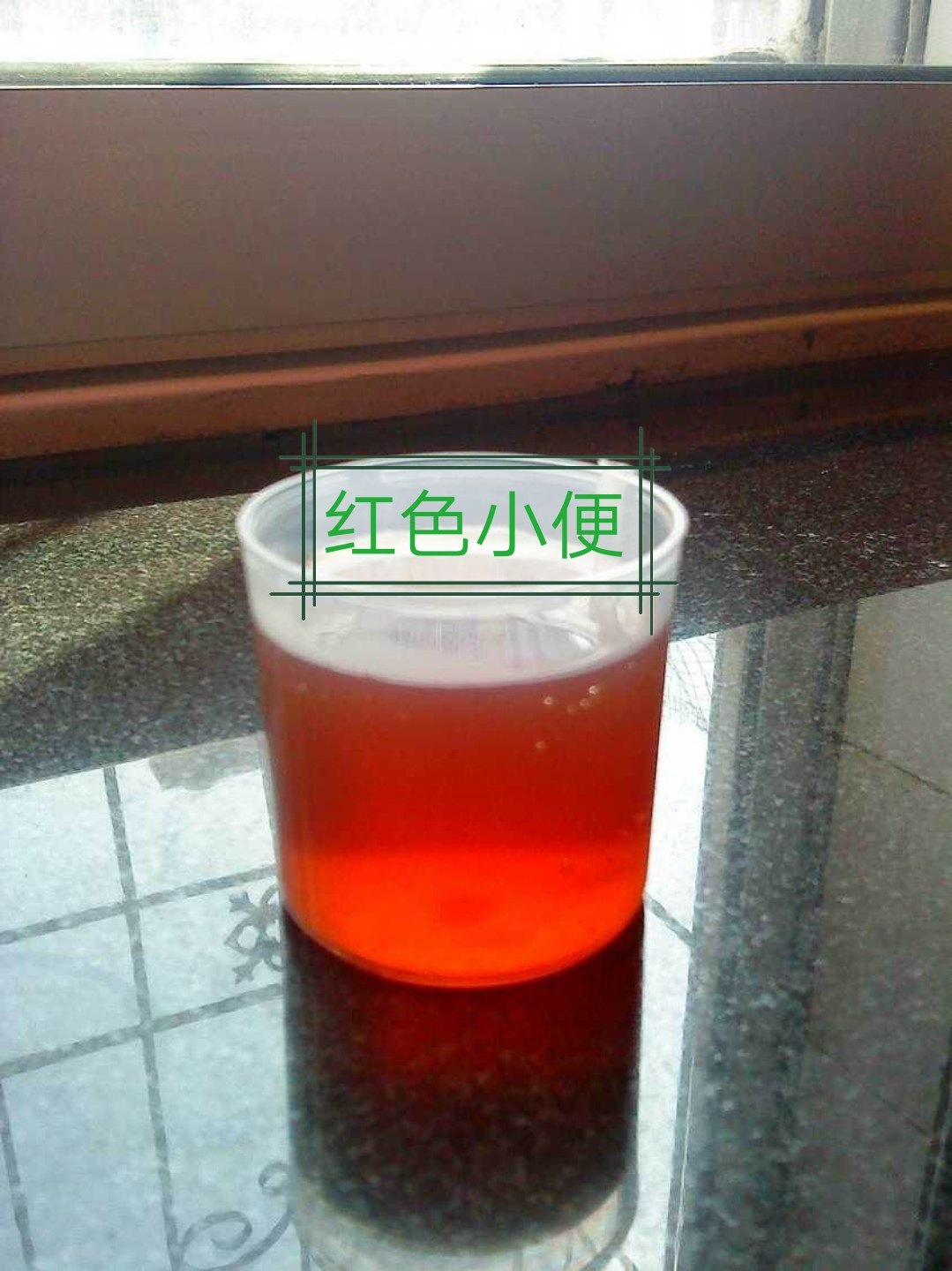 小便很红,医师为啥说没事儿?