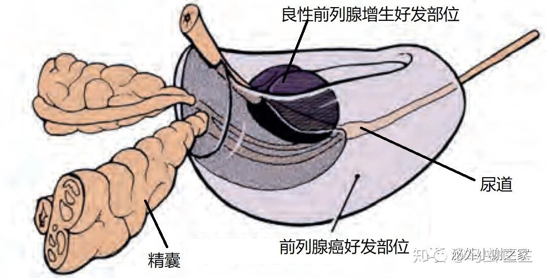 前列腺移行带和外周带图片