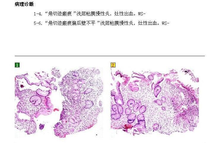 王和平3 病理.jpg