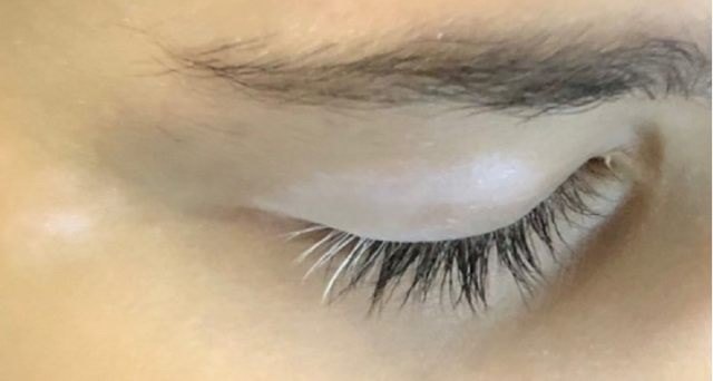 白癜风 - 好大夫在线