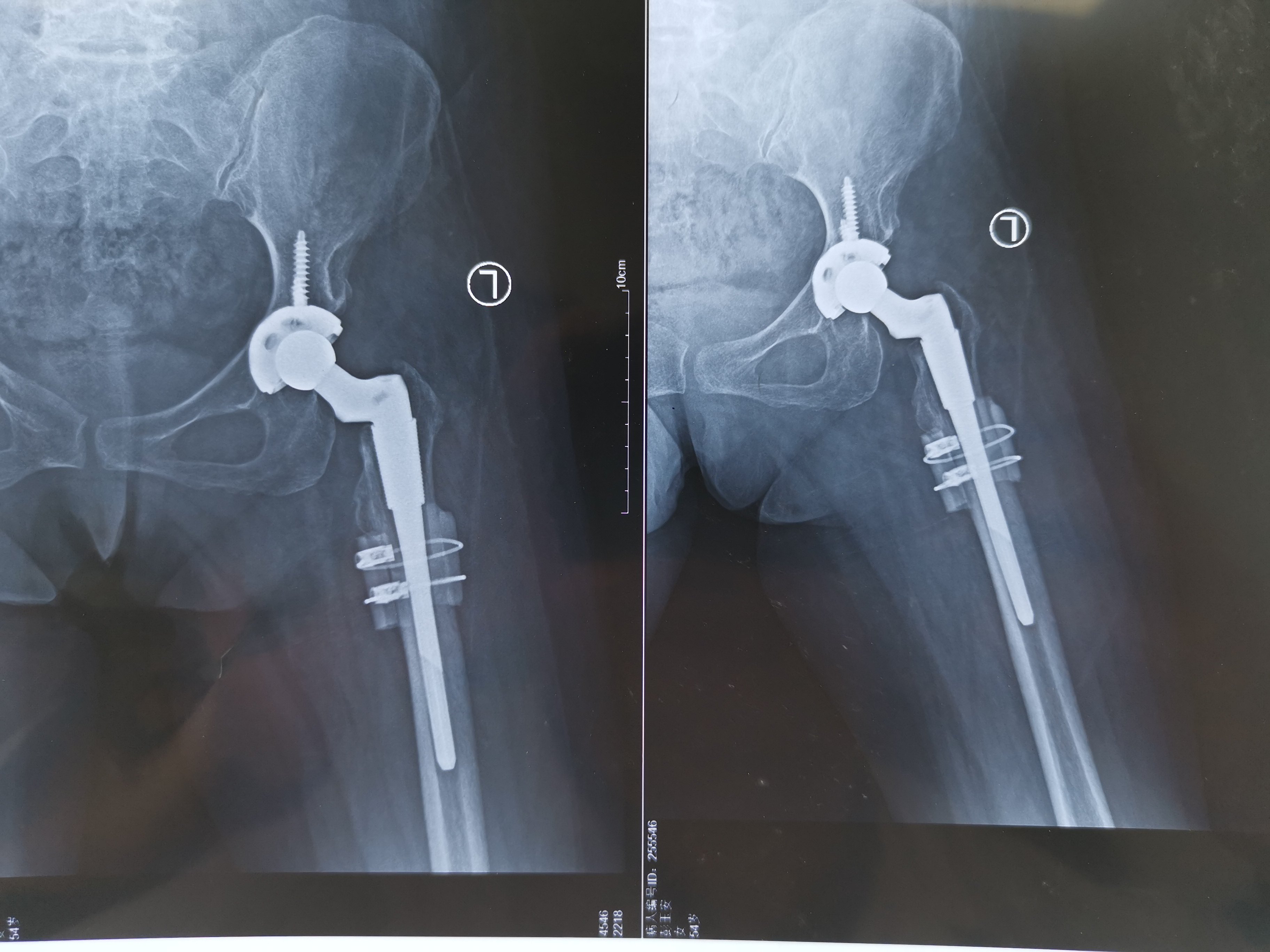 擅长:成人发育性髋关节发育不良、DDH人工关节置换术、运动医学。号贩子挂号联系方式_全天在线急您所急的简单介绍 擅长:成人发育性髋关节发育不良、DDH人工关节置换术、运动医学。号贩子挂号联系方式_全天在线急您所急的简单介绍