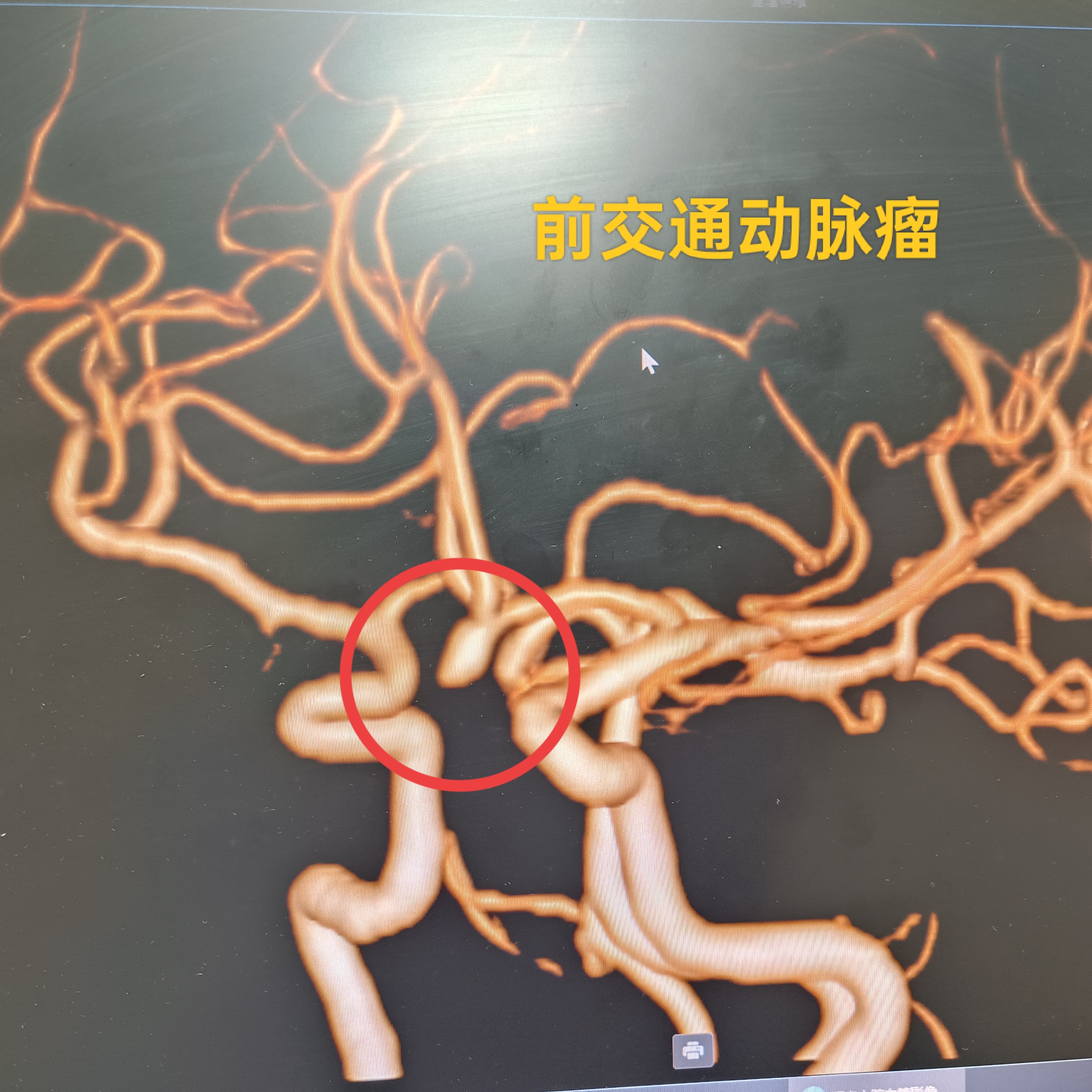 圖文圖片