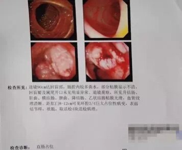 暂无