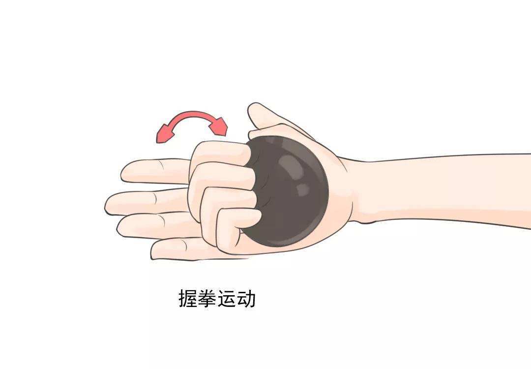 屈肌腱断裂修复后康复_手外伤_手外伤康复锻炼 - 好大夫在线