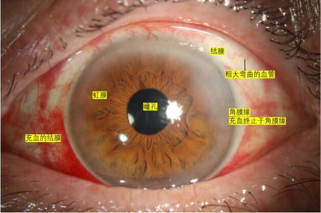 结膜病