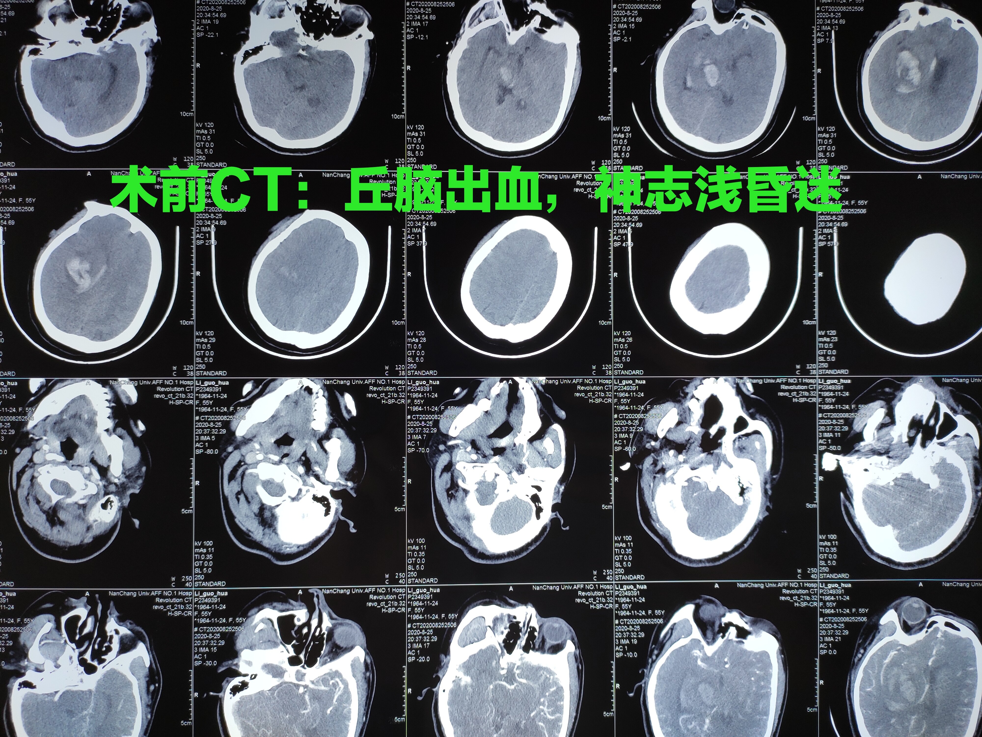 神经内镜软通道图片图片