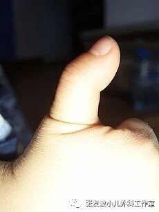 孩子的拇指为什么伸不直了