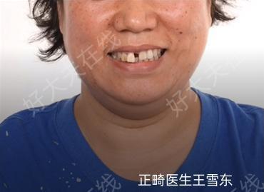 圖文圖片