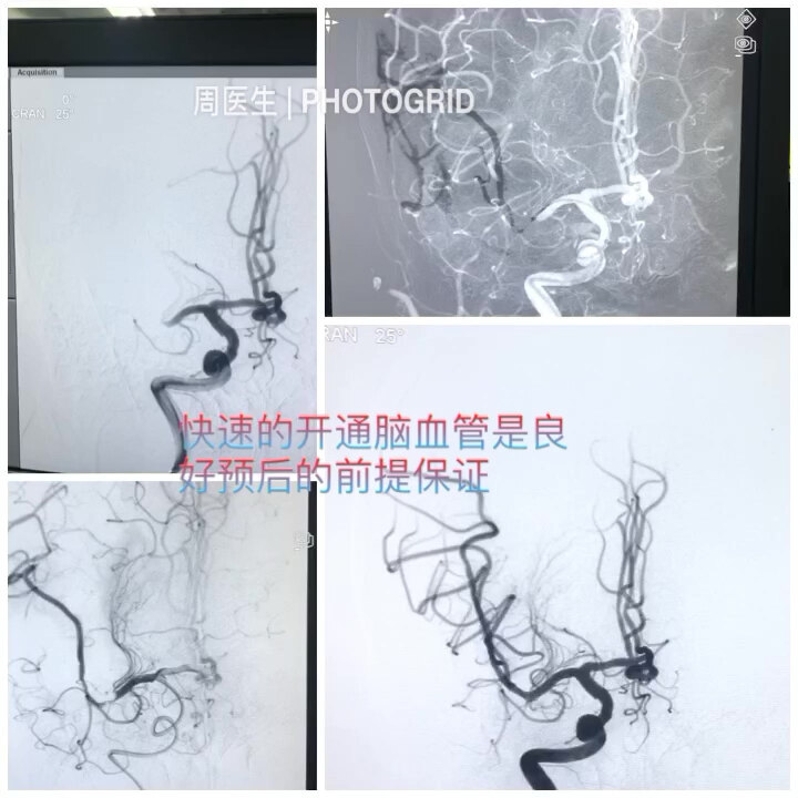 默认图片